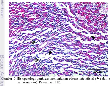 Gambar 6 Histopatologi pankreas menunjukan edema interstisial ( ►) dan atropi 