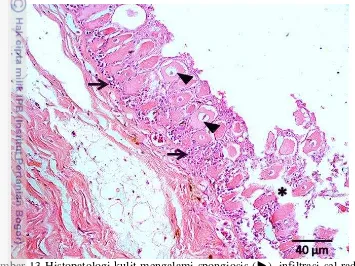 Gambar 13 Histopatologi kulit mengalami spongiosis  (►), infiltrasi sel radang 