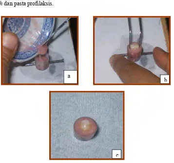 Gambar 12. Penanaman sampel dalam cetakan 