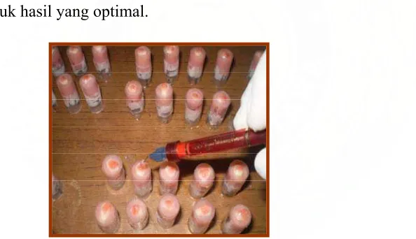 Gambar 13. Pengaplikasian Opalescence X-Tra Boost 