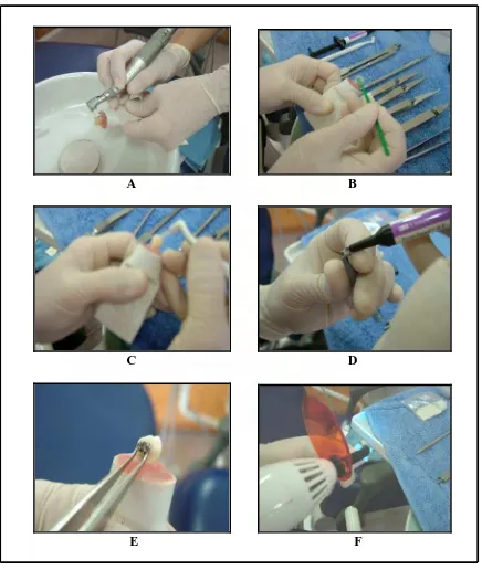 Gambar 3.9.  Aplikasi Elly Susianna : Perbedaan  Shear  Bond  Strength  Bahan   Adhesif Konvensional Dengan Self-Etching Primer/Adhesive  Pada  Bonding Breket   Ortodonti, 2009