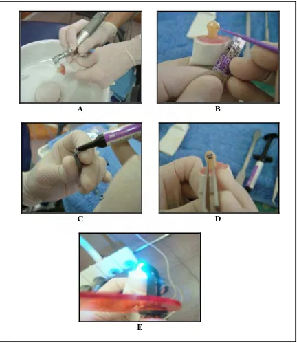 Gambar 3.11.  Aplikasi  Transbond  Plus  Self-Etching  Primer,  A. Permukaan bukal gigi dibersihkan dengan pumice menggunakan rubber cup, B