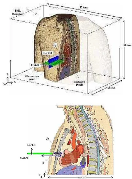 Figure 1 Layout of human chest with implanted antenna [11]  