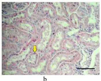 Gambar 9  (a) Kongesti di daerah tepi tubulus ginjal. (b) Nekrosa koagulatif 