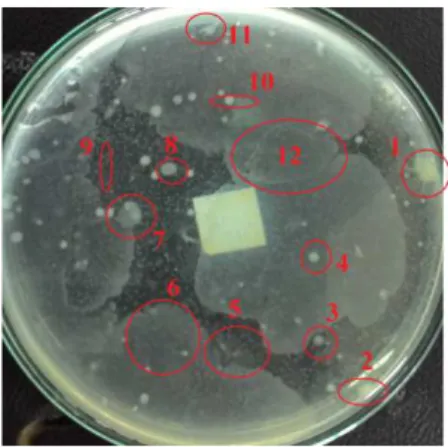 Gambar 4.1 Foto Koloni Bakteri pada Pengenceran ke-11 