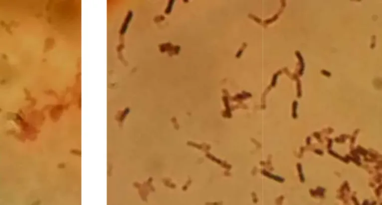 Gambar 4.4. Bentuk sel bakteri genus Pseudomonas (a) isolat B dan (b) isolat B-11,  perbesaran 1000x 