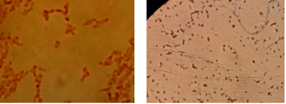 Gambar 4.2. Bentuk sel bakteri genus Paracoccus (a) isolat B  dan (b) isolat B-6, perbesaran 1000x 