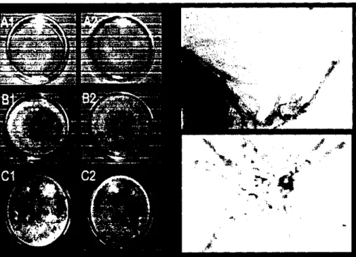 Gambar 6B. Karakteristik makrokopis dan mikrokopis penebab penyakit bercak  daun Cercospora {Cercospora elaeidis),  A l = Karakteristik 