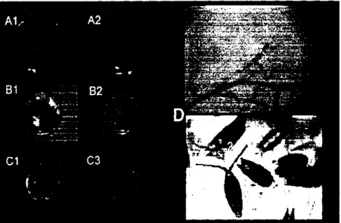 Gambar 4. Karakteristik makrokopis dan mikrokopis penyebab penyakitb bercak  daun Pestalotia (Pestalotia sp) A1 = Karakteristik makrokopis (3 hsi)  tampak depan, A2 = Karakteristik makrokopis (3 hsi), tampak  belakang, B1 = Karakteristik makrokopis (7 hsi)