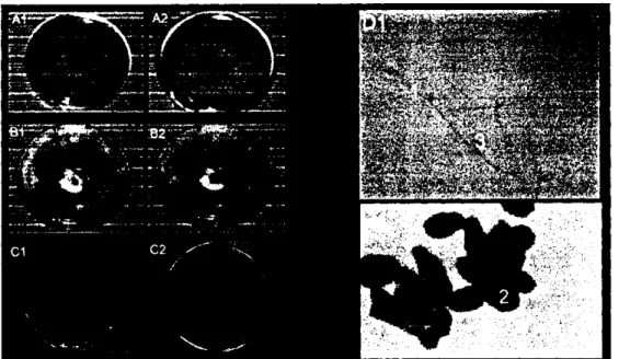 Gambar 5.B. Karakteristik makrokopis dan mikrokopis penyebab bercak daun  Curvularia {Curvularia lunata),  A l = Karakteristik makrokopis  (3 hsi) ,tampak depan ,A2 = Karakteristik makrokopis (3 hsi),  tampak belakang, B1 = Karakteristik makrokopis (7 hsi)