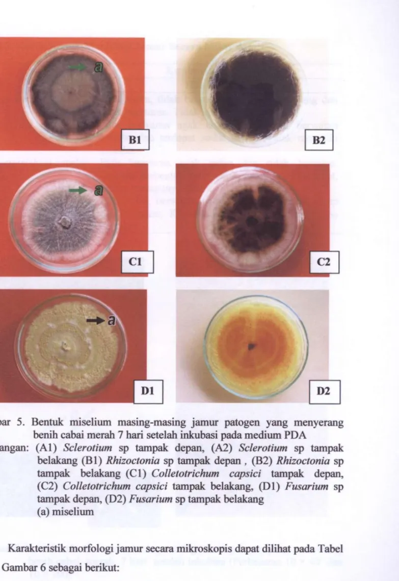 Gambar 5. Bentuk miselium masing-masing jamur patogen yang menyerang  benih cabai merah 7 hari setelah inkubasi pada medium PDA 