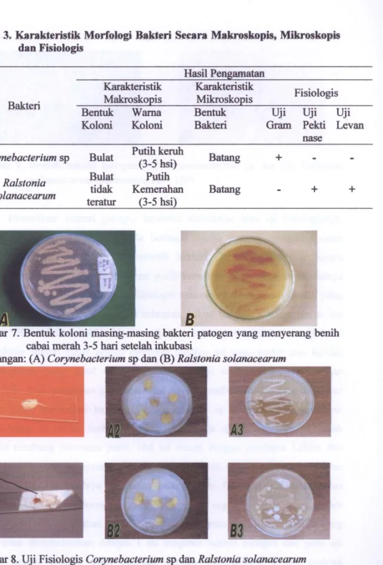 Tabel 3. Karakteristik Morfologi Bakteri Secara Makroskopis, Mikroskopis  dan Fisiologis  Hasil Pengamatan  Bakteri  Karakteristik Makroskopis  Karakteristik Mikroskopis  Fisiologis Bakteri 