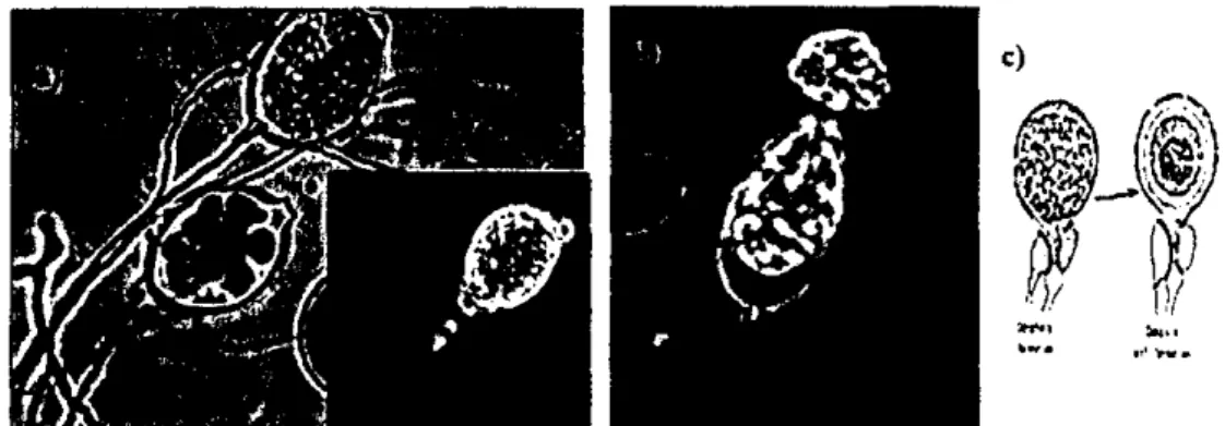 Gambar 2. Phytophthora palmivora, a. Sporangium (Zoosporangium)/Spora  Aseksual pada Miselium, b