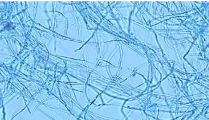 Gambar  9.  Marasmius  Sp.  pada  inkubasi  3  hari  (foto  mikroskopis  10  x40  pewarnaan  lactofenol cottonblue )   
