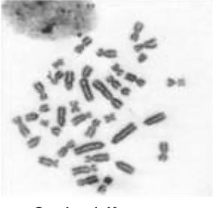 Gambar 1. Kromosom 