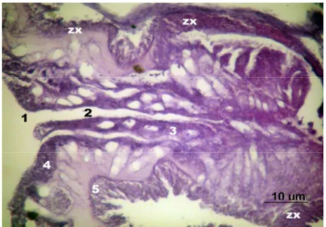 Gambar 25. Penampang vertikal bagian antokodia dari Sinularia dura setelah  dilakukan transplantasi karang lunak selama 10 bulan