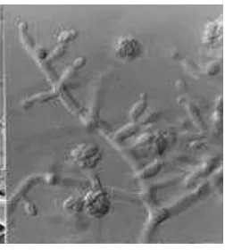 Gambar 3 . Trichoderma secara mikroskopis Sumber: Hook, Mycobank 2000 dalam jamila 2011 