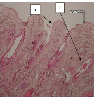 Gambar 3.  Fotomikrograf penampang melintang kulit domba proses unhairing menggunakan enzim  protease Aspergillus sp
