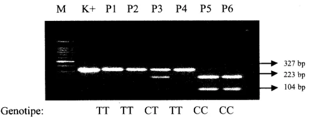 Gambar 2. Elektroforesis produk PCR-RFLP gen hormon pertumbuhan menggunakan enzim pemokmg A lui