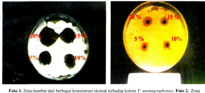 Foto 1. Zona hambat dari berbagai konsentrasi ekstrak terhadap koloni T. mentagrophytees