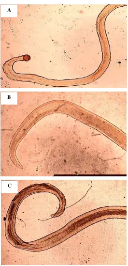 Gambar 6  Larva Anisakidae berdasarkan spesiesnya (A) Anisakis simplex,  (B) 