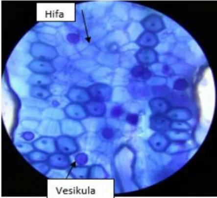 Gambar 2. Hifa dan vesikula yang ditemukan pada akar bibit aren berumur 19 bulan. 