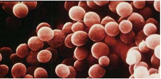 Gambar 3. Staphylococcus aureus yang Dilihat dari Mikroskop Elektron. Sumber Todar, 2008 