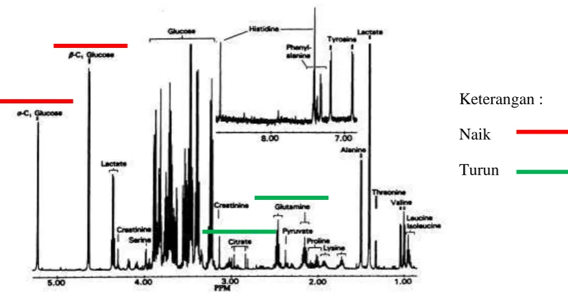 Gambar 10. Analisis kemungkinan spektra NMR TB Paru pada Anak ( 7) 