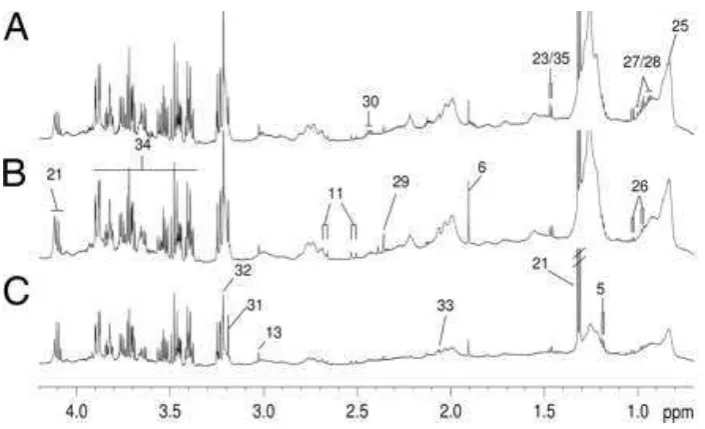 Gambar 3. Spektroskopi NMR pada kasus Trypanosomiasis ( 
