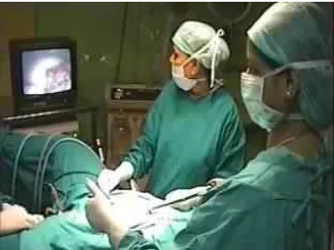 Gambar 2. Pemeriksaan patensi tuba dengan laparoskopi