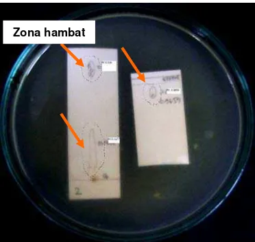 Tabel 7  Morfologi bakteri simbion yang berhasil diisolasi dari spons Aaptos aaptos 