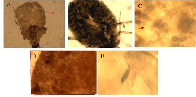Gambar 7 Pengamatan makroskopis dan mikroskopis kutudaun (A) tubuh ku-tudaun sehat (B) tubuh kutudaun hitam, (C) konidia primer, (D) badan hifa berbentuk bulat, (E) cendawan saprofitik