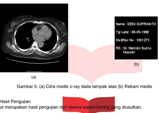 Gambar 5. (a) Citra medis x-ray dada tampak atas (b) Rekam medis 