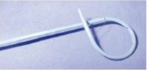 Gambar 8. Setelah menembus rongga abses, jarum ditarik dan kawatkhusus dimasukkan ke dalam rongga abses
