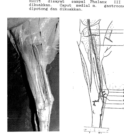 Gambar 8. Daerah kaki medial,kanan. 