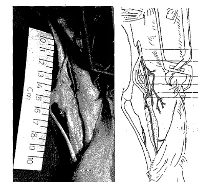 Gambar 9. Daerah Tarsus medial, kiri. 