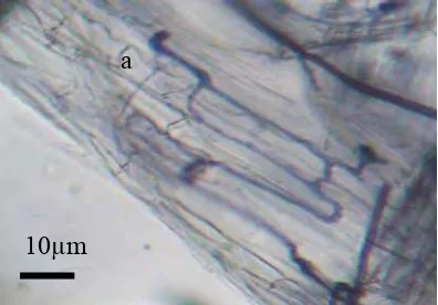 Gambar 6 Pengaruh inokulasi ganda cendawan mutualistik akar mikoriza dan non mikoriza pada  Centrosema pubescen umur 3 bulan pada taraf P 50%  