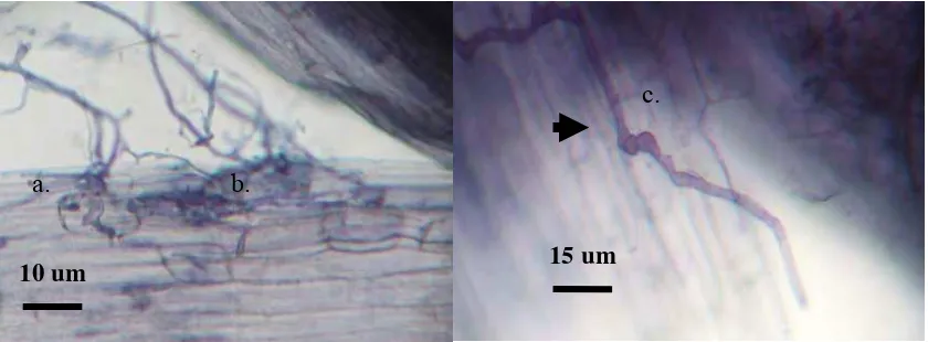 Gambar 7 Struktur kolonisasi fungi A. niger 1 di dalam akar pada umur 6 mingu  setelah inokulasi pada perbesaran 10 x