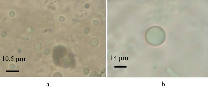 Gambar 9 Speroplas segar cendawan  A. niger setelah pemurnian dengan sistem dua fase sukrosa dan manitol