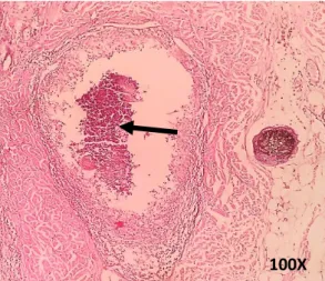 Gambar 5. Adanya infiltrasi sel radang  pada  folikel  rambut    (          ).  Pewarnaan  HE (Hematoxylin dan eosin)