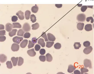 Gambar 1. Foto apus pelet eritrosit dalam kultur + artemisinin + asam askorbat  konsentrasi 20 µM dengan perbesaran 1000 kali