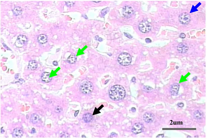 Gambar 6a. Gambaran histopatologi jaringan hati kelompok kontrol. Lesio hepatosit berupa degenerasi hidropis (panah hijau), nekrosa (panah hitam) dan hepatosit normal (panah biru)