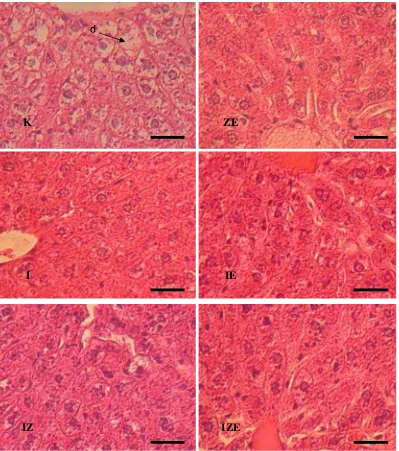 Gambar 6. Fotomikrograf jaringan hati dengan pewarnaan hematoksilin eosin. K = ransum standar tanpa isoflavon maupun vitamin E dan Zn, I = ransum standar dengan isoflavon, ZE = ransum standar dengan vitamin E dan Zn, IE = ransum standar dengan isoflavon da