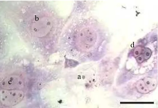 Gambar 9 Morfologi sel-sel trofoblas yang telah mengalami diferensiasi. (a) Sitotrofoblas, (b) Trophoblast Giant Cell (TGC), (c) Sinsitiotrofoblas, (d) Spongiotrofoblas