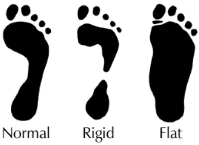 Figure 2.1: Type of feet. (Etchison, 2009) 