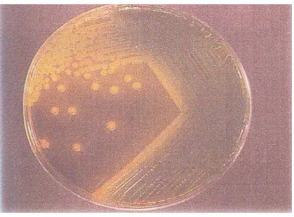 Gambar 2. Vibrio cholerae pada media TCBS selama 18 jam pada suhu 37°C menghasilkan koloni berwarna 