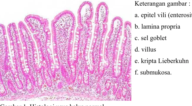 Gambar 1  Histologi usus halus normal. 