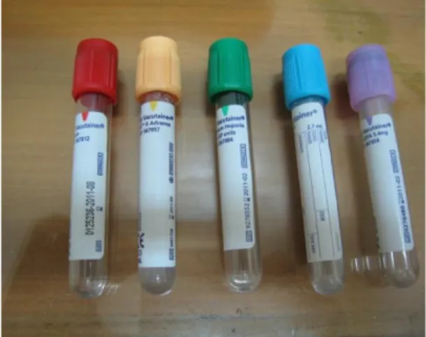 Gambar 4.2  Ini adalah vacutainer yang digunakan untuk pengambilan sampel  darah pasien, warna tutup yang berbeda pada tabung untuk membedakan isi 