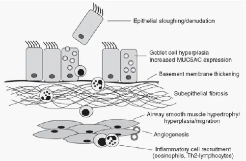 Gambar 5 . Airway remodeling pada asma kronik. 