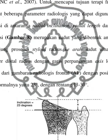 Gambar 8. Radial inclination  